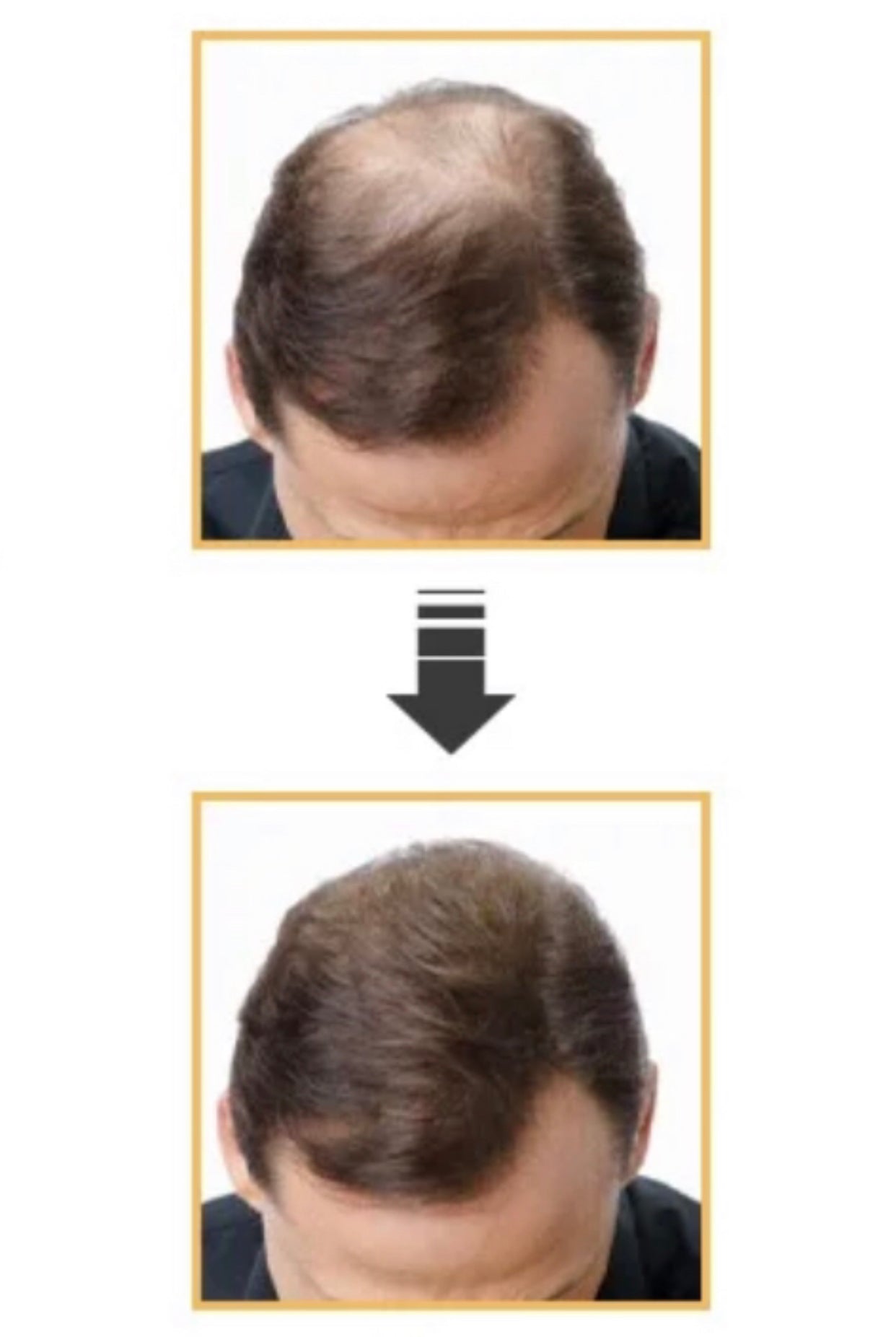 Pure & Powerful Organic Hair Growth Oil – Nourishment for All Hair Types