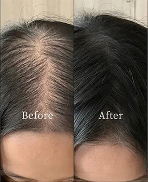 Pure & Powerful Organic Hair Growth Oil – Nourishment for All Hair Types