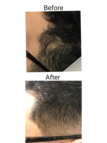 RootMuse™ Elixir Herbal Scalp & Hair Nourishing Oil 2- pack