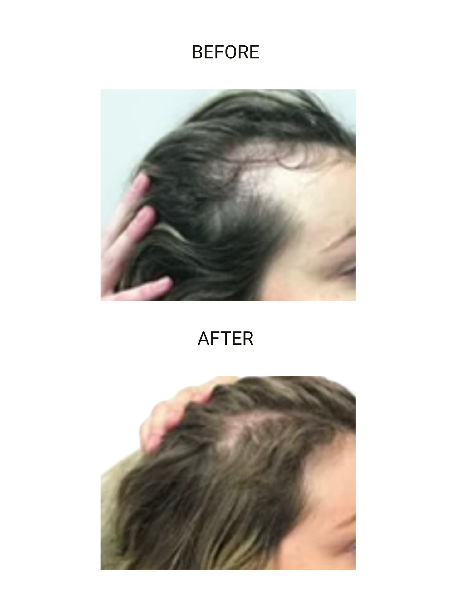 SHARIF BEAUTY RootMuse™ Elixir Herbal Scalp & Hair Nourishing Oil