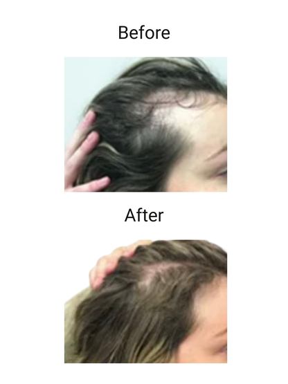 RootMuse™ Elixir Herbal Scalp & Hair Nourishing Oil 3- pack
