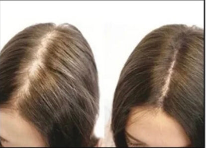 RootMuse™ Elixir Herbal Scalp & Hair Nourishing Oil 3- pack