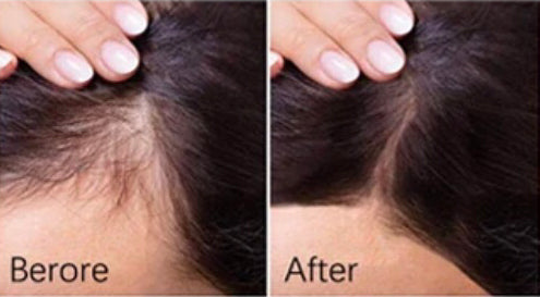 SHARIF BEAUTY RootMuse™ Elixir Herbal Scalp & Hair Nourishing Oil